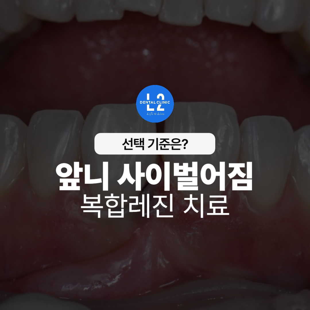 "앞니 사이가 벌어진 치아에 대한 복합레진 치료 선택 기준 안내 이미지"