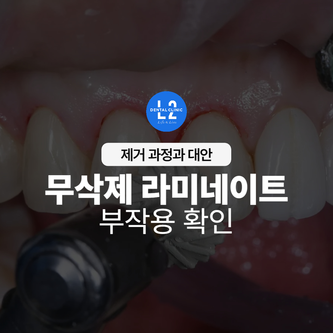 무삭제 라미네이트 제거 시술 장면 클로즈업