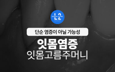 잇몸염증·잇몸고름주머니, 단순 염증이 아닐 수 있습니다