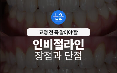 인비절라인 장점과 단점, 교정 전 꼭 알아야 할 것들