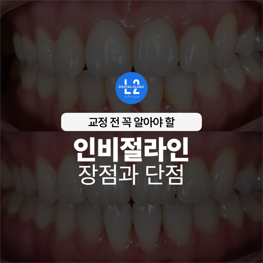 인비절라인 교정 전후 비교 이미지