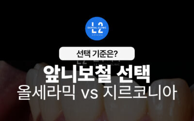 앞니보철, 올세라믹 vs 지르코니아 선택 기준은?