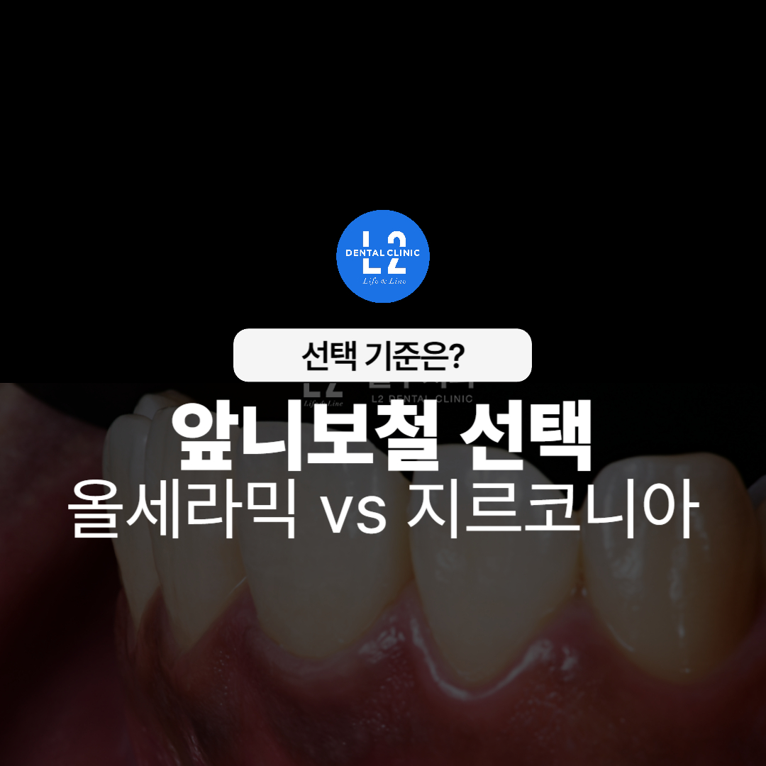 앞니보철 치료 전 실제 치아 사진과 "올세라믹 vs 지르코니아" 비교 텍스트
