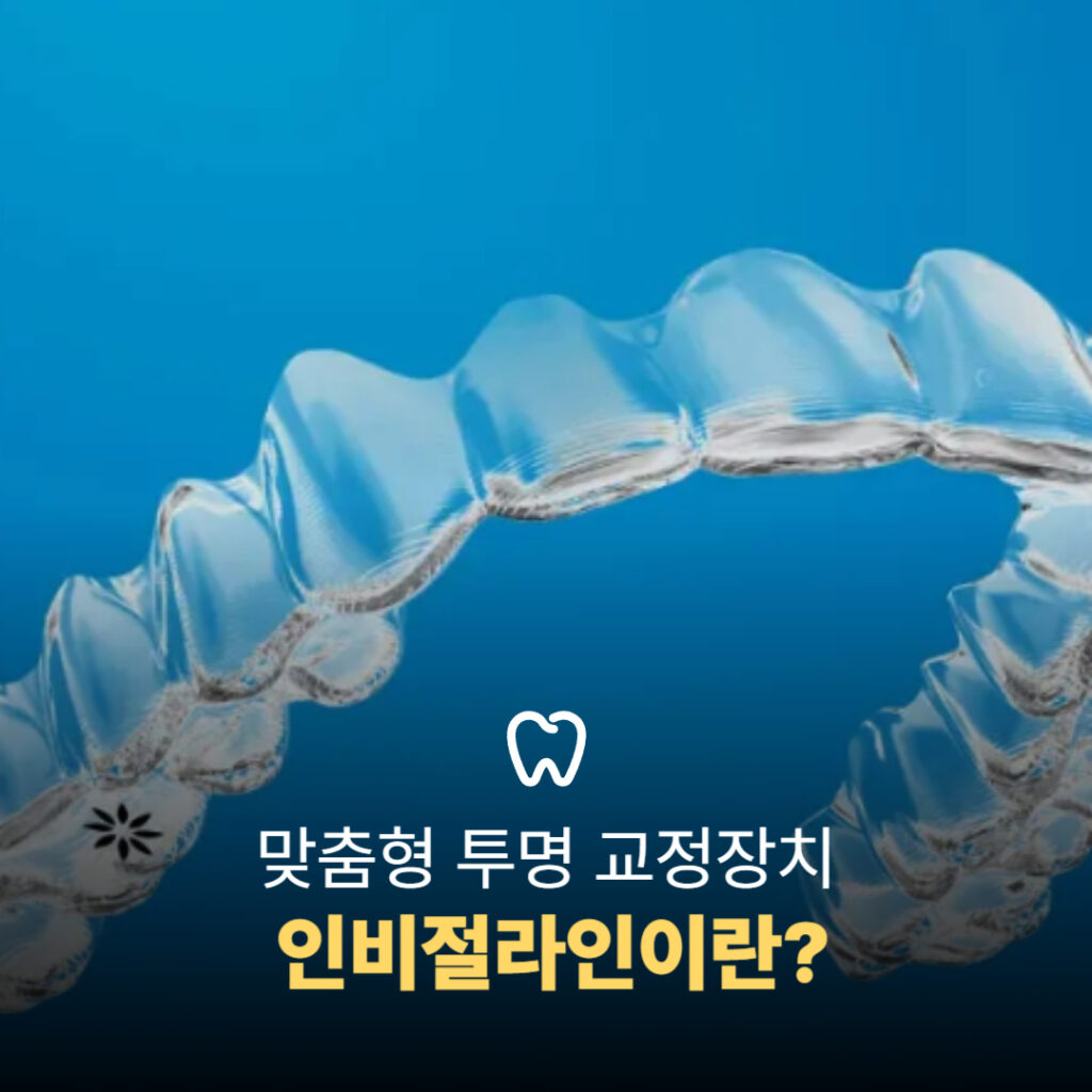 투명한 인비절라인 교정장치 클로즈업