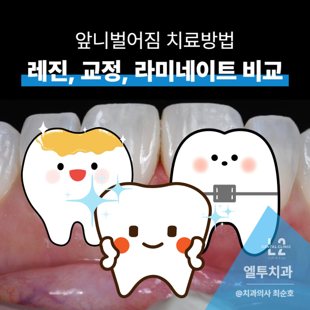 앞니 치료 방법으로 레진, 교정, 라미네이트를 비교한 이미지