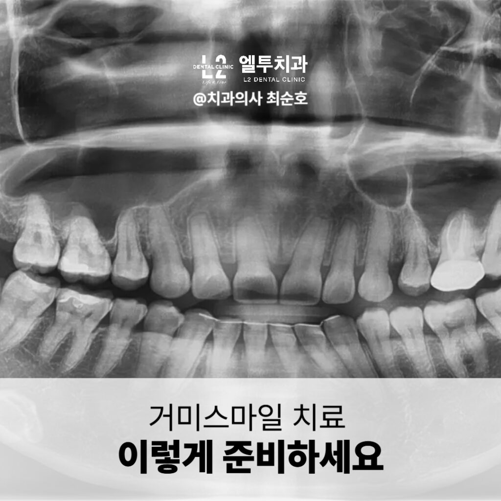 치아와 잇몸 상태 확인을 위한 파노라마 엑스레이 이미지