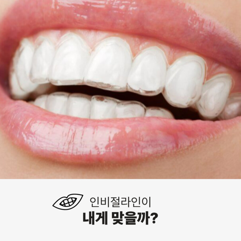 인비절라인 장치를 착용한 여성의 미소 클로즈업