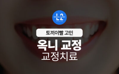 옥니 교정, 꼭 교정치료만 답일까요?