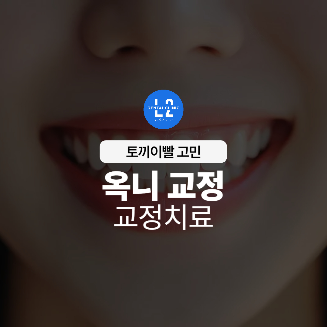활짝 웃는 입술과 돌출된 앞니가 보이는 모습
