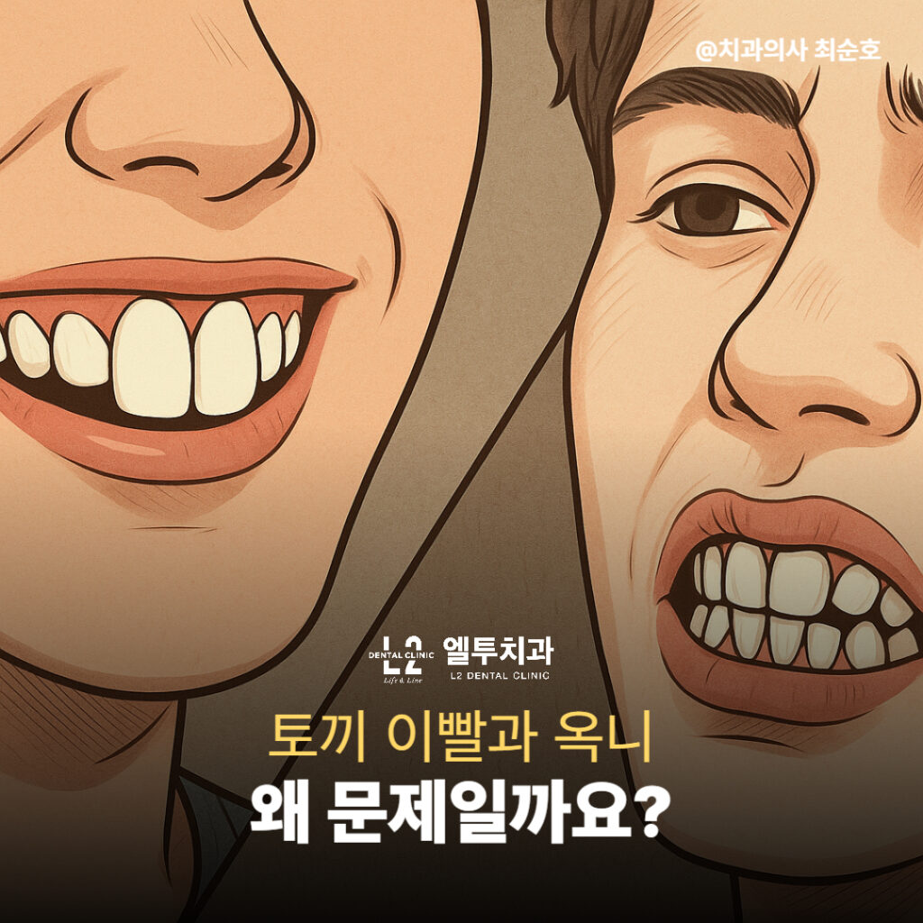 토끼이빨과 옥니를 표현한 일러스트
