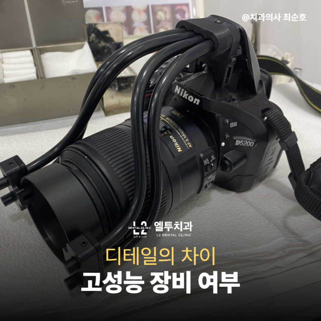 치아 색상과 표면 질감을 기록하기 위한 DSLR 카메라 이미지
