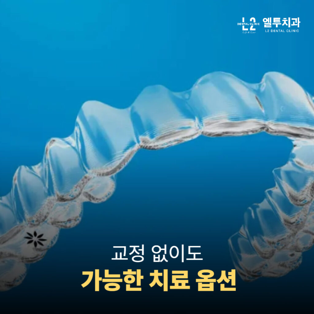 투명 교정 장치의 클로즈업 이미지