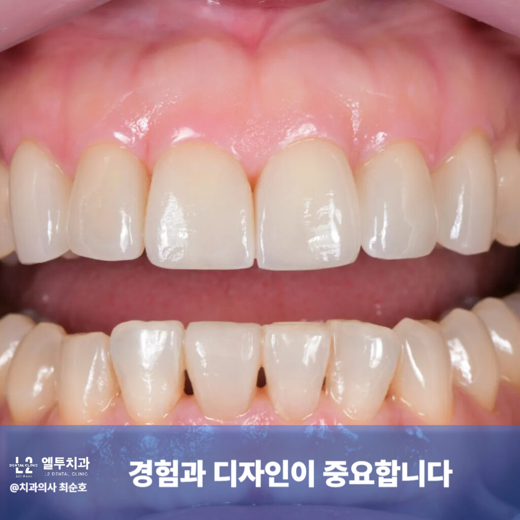 블랙트라이앵글 치료에서 경험과 디자인의 중요성 강조 이미지