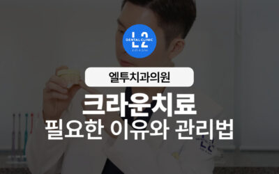 크라운치료 치아 손상·신경치료 후 꼭 필요한 이유와 관리법