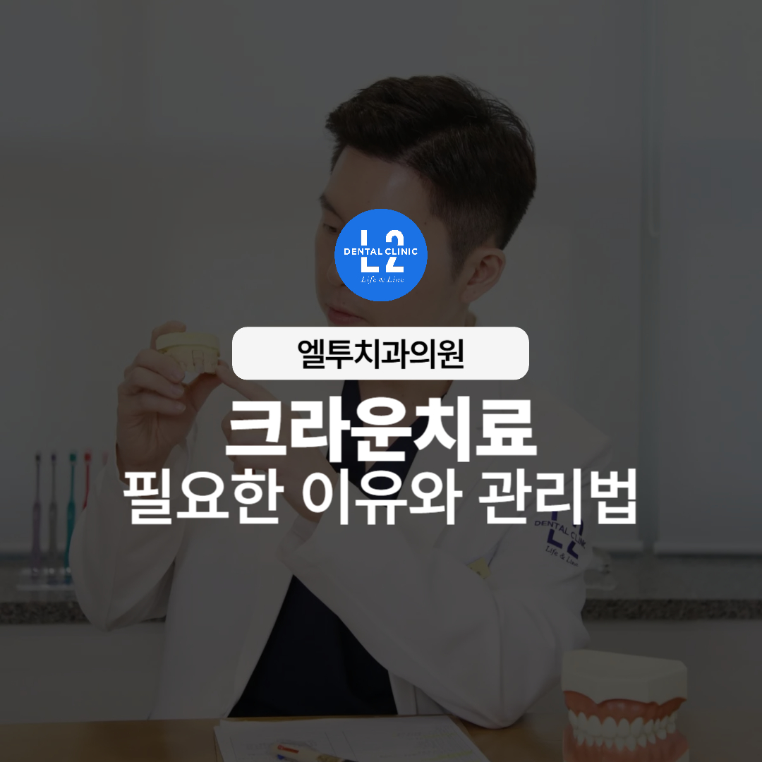치과의사가 치아 모형을 들고 크라운치료 필요성과 과정을 설명하는 모습