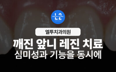 깨진 앞니 레진 치료, 심미성과 기능을 동시에