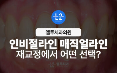 인비절라인 매직얼라인, 재교정에서 어떤 선택이 맞을까?