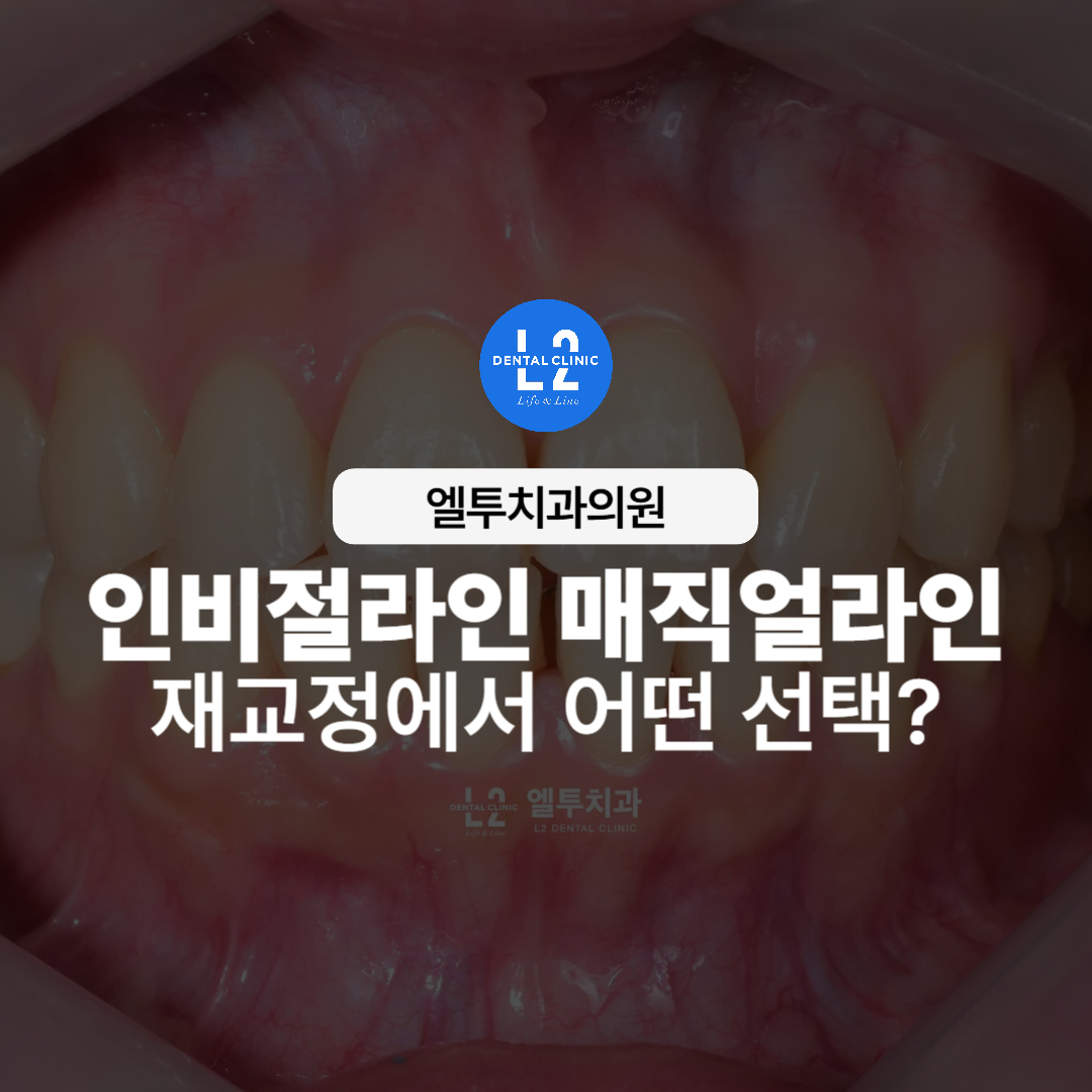 엘투치과 인비절라인 매직얼라인 재교정 소개 이미지