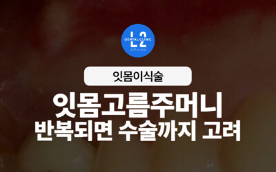 잇몸고름주머니, 반복되면 수술까지 고려해야 하는 이유