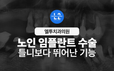 노인 임플란트 수술, 틀니보다 뛰어난 기능과 심미성 회복 사례