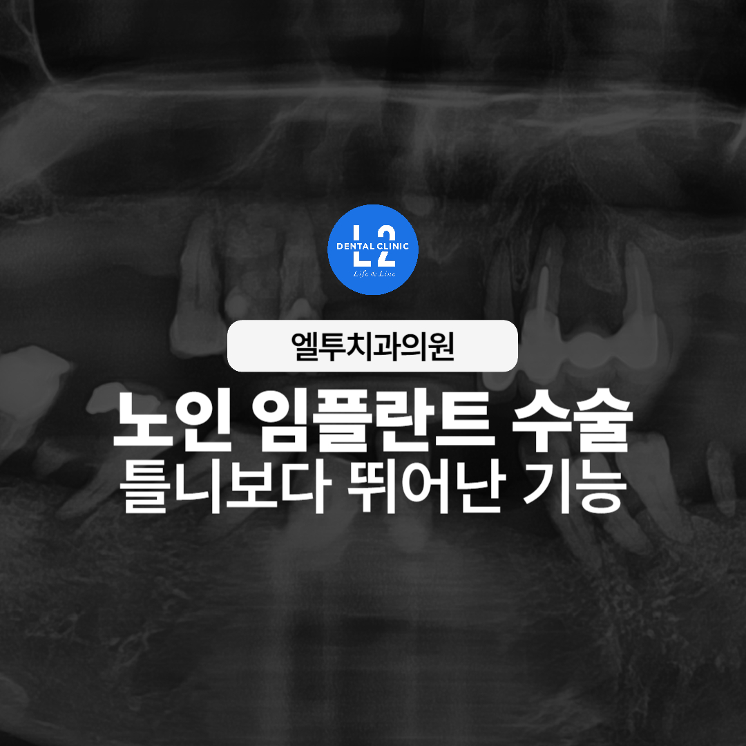 파노라마 엑스레이로 확인한 노인 임플란트 수술 전 구강 상태와 임플란트 계획 안내 이미지