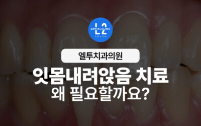 잇몸내려앉음 치료, 왜 필요할까요?