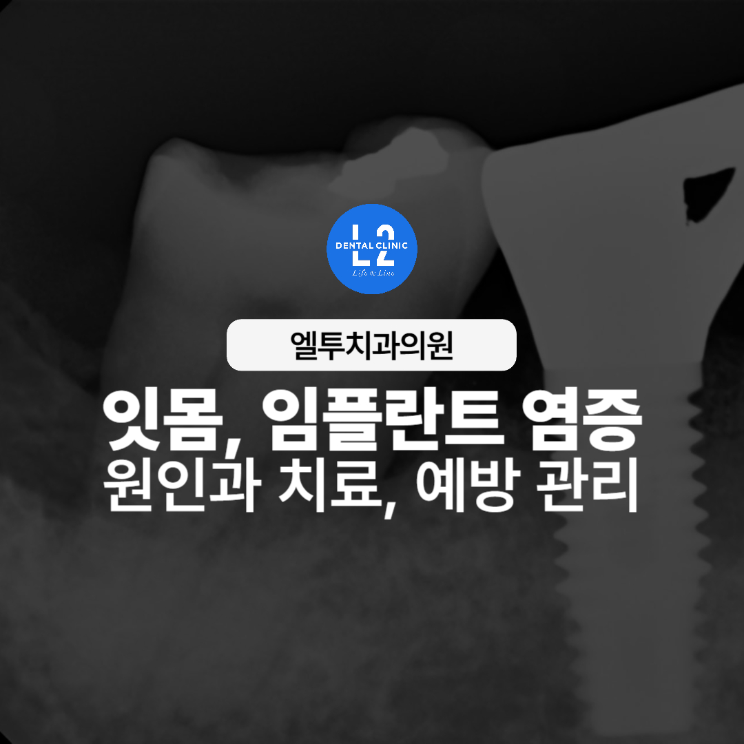 임플란트 주변 잇몸염증을 보여주는 치과 엑스레이 사진
