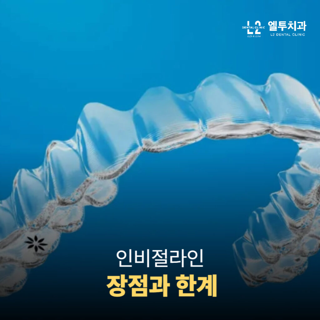 투명교정 장치 인비절라인 클로즈업 사진