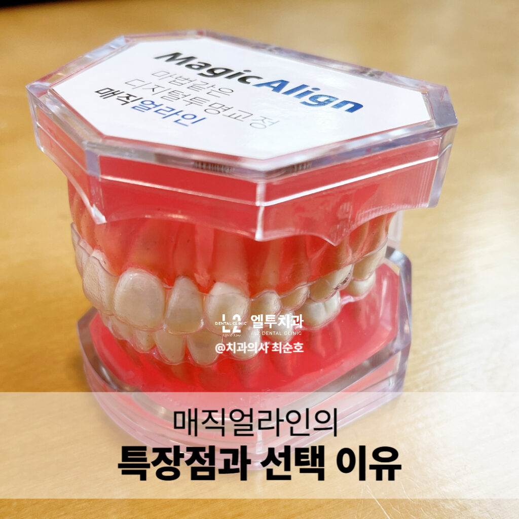 매직얼라인 투명교정 장치 모형