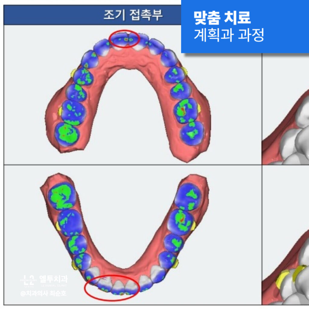 디지털 교정 시뮬레이션 화면