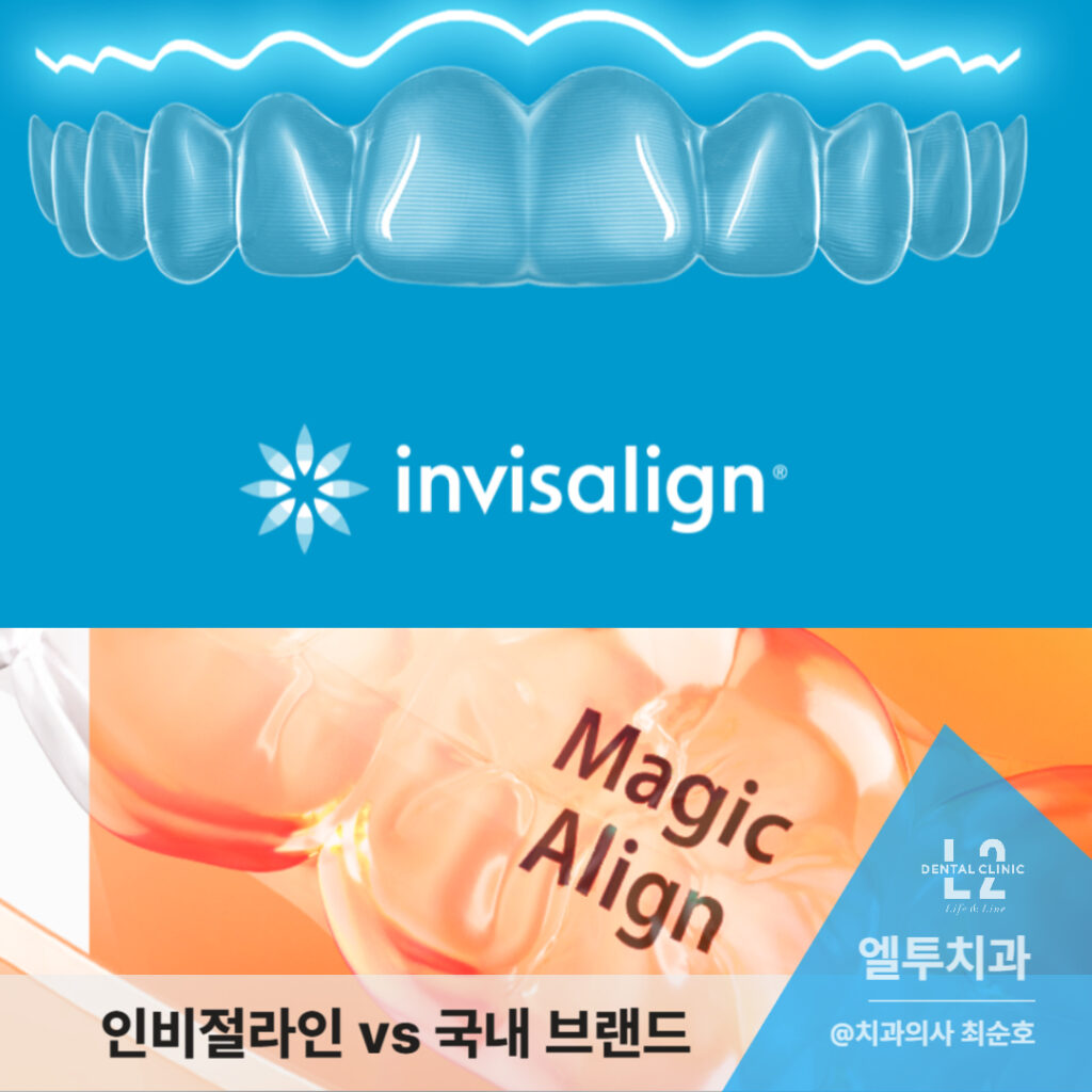인비절라인과 매직얼라인을 비교하는 이미지