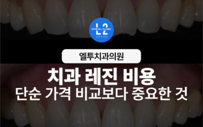 치과 레진 비용, 단순 가격 비교보다 중요한 것