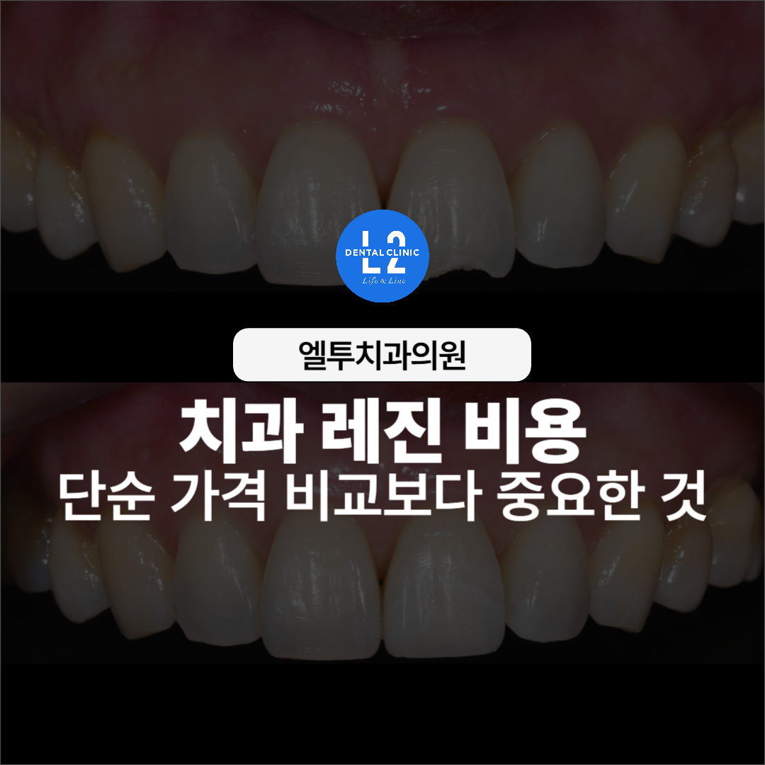 치과 레진 비용 관련 안내 표지 이미지