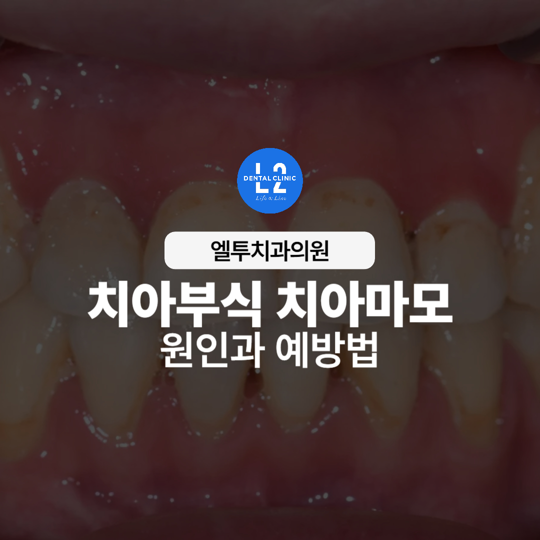 치아부식과 치아마모로 손상된 치아 사진 위에 제목 텍스트가 표시된 이미지