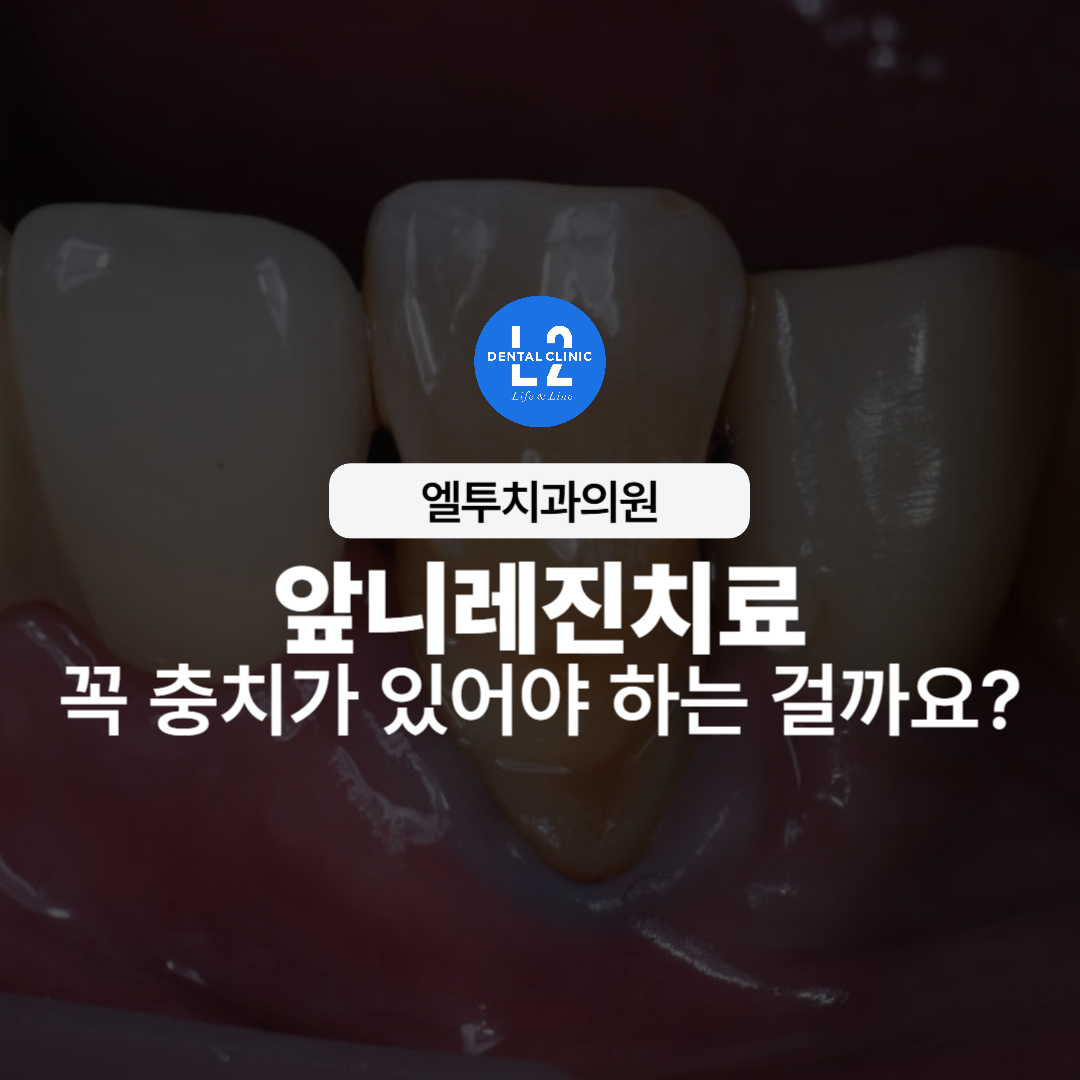 앞니에 충치 없이도 레진치료가 필요한 경우를 안내하는 이미지