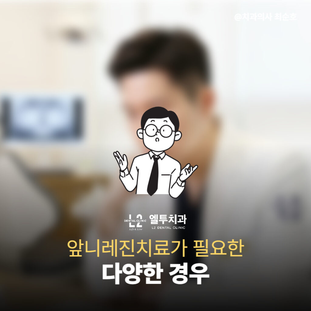 의사 일러스트와 함께 앞니레진치료가 필요한 다양한 경우 안내
