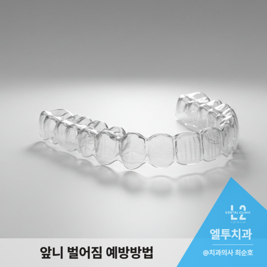 앞니 벌어짐 예방을 위한 투명 교정 장치 사진