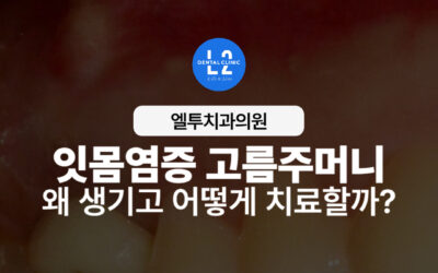 잇몸염증 고름주머니, 왜 생기고 어떻게 치료해야 할까?