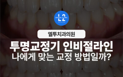 투명교정기 인비절라인, 나에게 맞는 교정 방법일까?