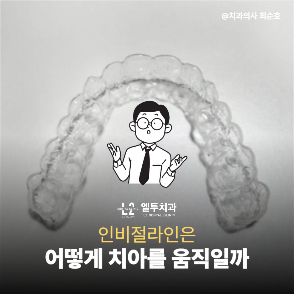 투명한 인비절라인 교정기를 손에 들고 있는 삽화 이미지