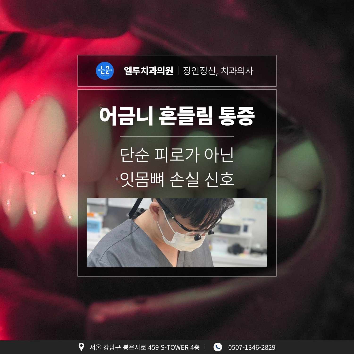 어금니 흔들림 통증, 잇몸뼈 손실로 인한 치주염 초기 신호