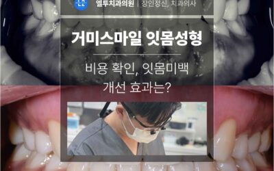 거미스마일 잇몸성형 비용 확인, 잇몸미백 개선 2년 후기