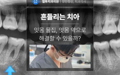 흔들리는 치아 잇몸 물집, 잇몸 약으로 해결할 수 있을까?