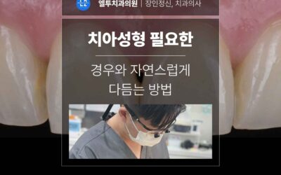 치아성형 필요한 경우와 자연스럽게 다듬는 방법