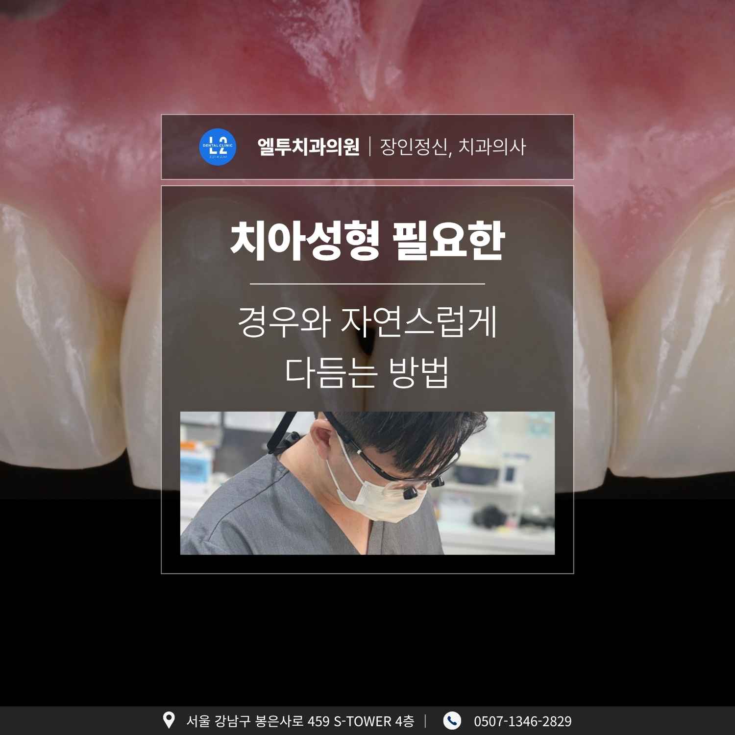 치아성형 필요한 경우와 자연스럽게 다듬는 방법 치아성형이 필요한 앞니를 살펴보는 치과의사 모습