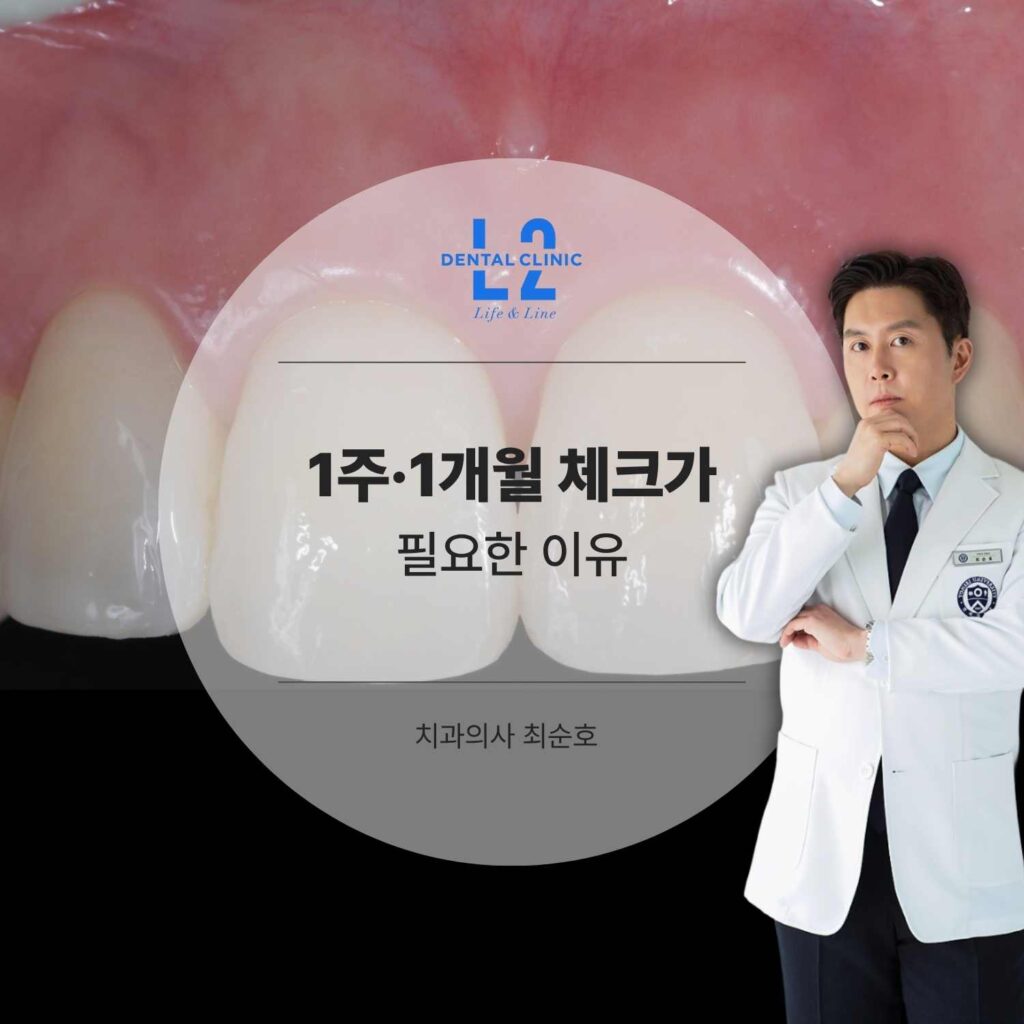 앞니 레진 비니어 치료 후 치과 전문의가 설명하는 모습