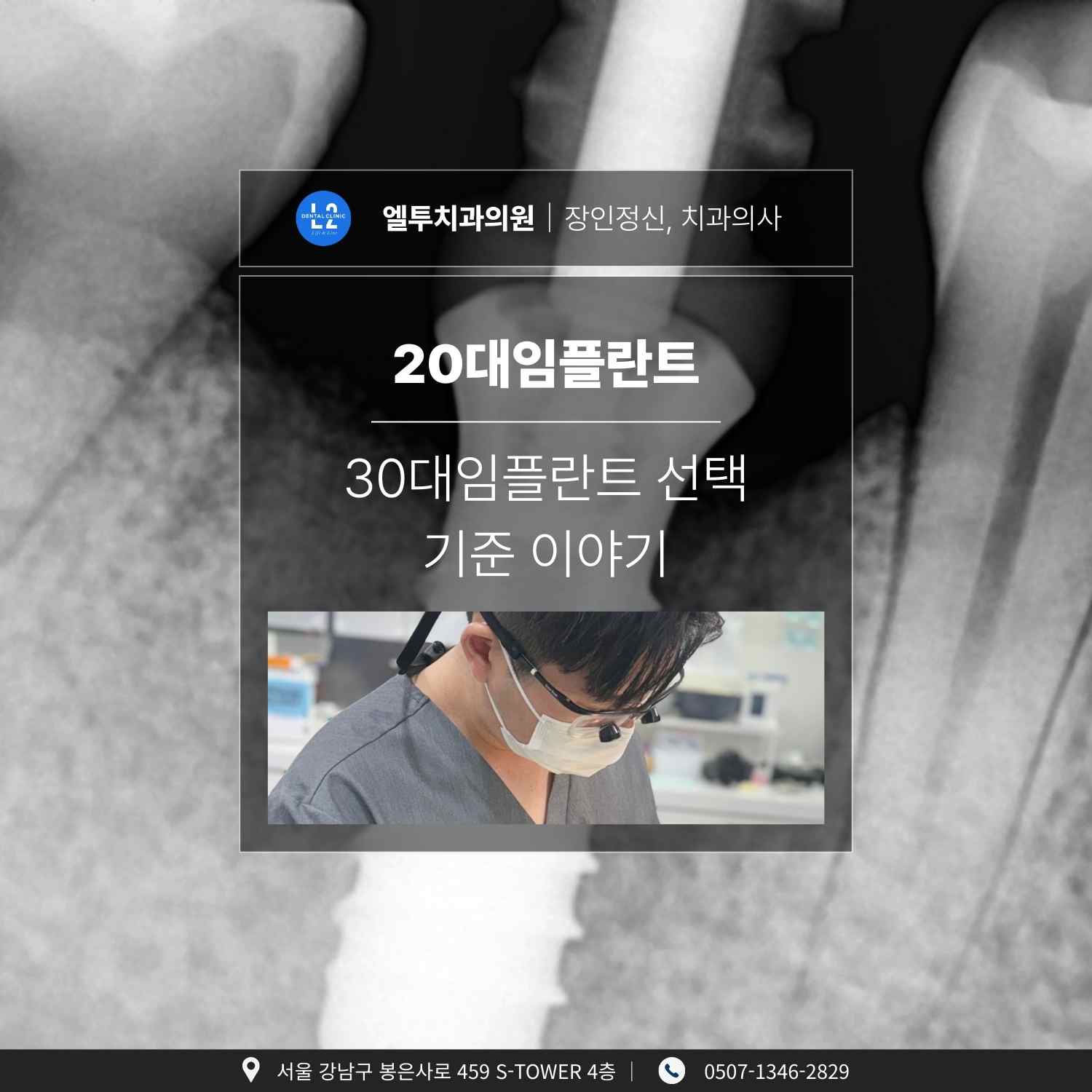 20대임플란트와 30대임플란트 선택 기준을 설명하는 썸네일 이미지