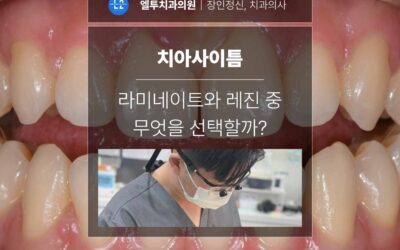 치아사이틈, 라미네이트와 레진 중 무엇을 선택할지 먼저 봐야 합니다