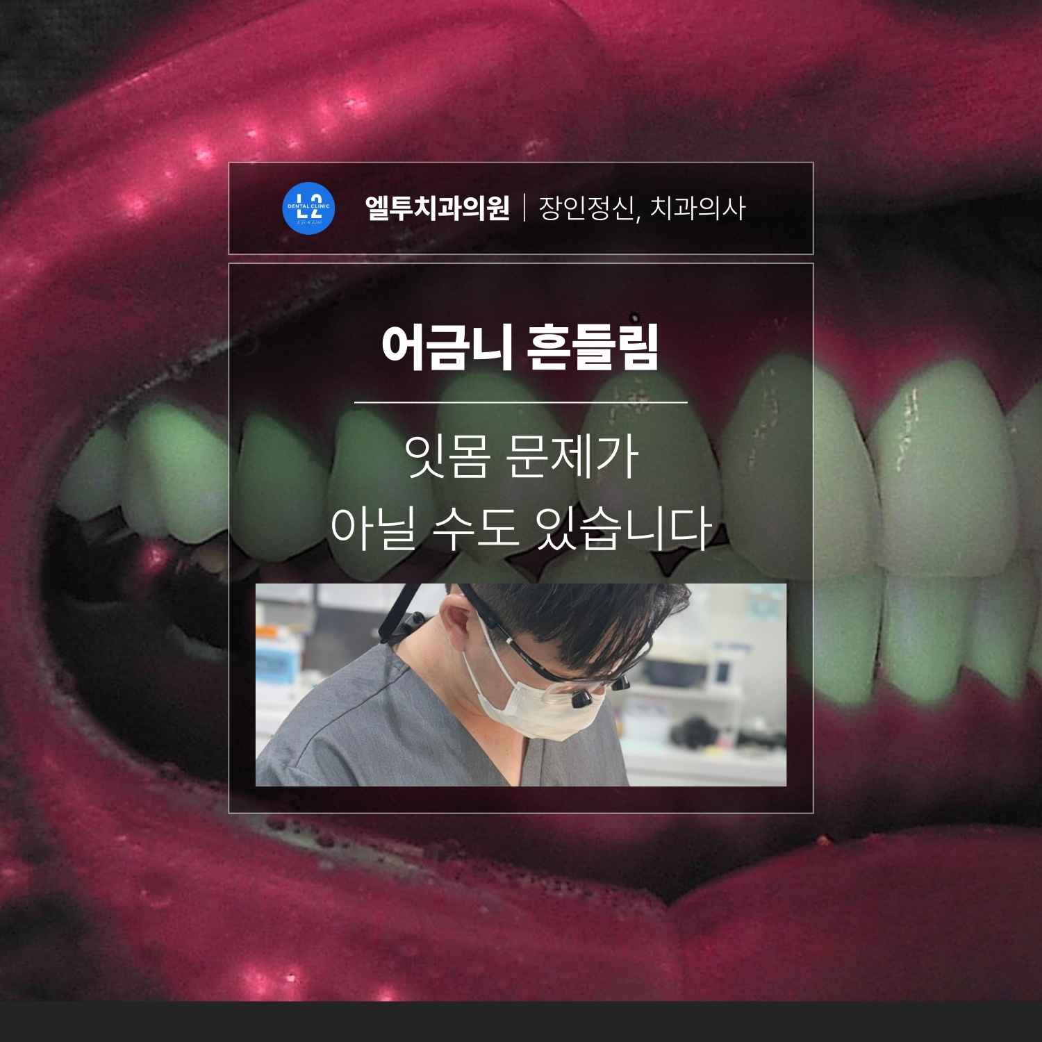 어금니 흔들림, 잇몸 문제만이 원인은 아닙니다 어금니 흔들림이 잇몸 문제가 아닐 수 있음을 설명하는 치과 진료 이미지