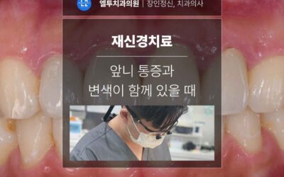 재신경치료, 앞니 통증과 변색이 함께 있을 때 먼저 판단해야 합니다